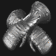 Sigon's Gage